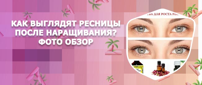 Как улучшить рост ресниц после наращивания